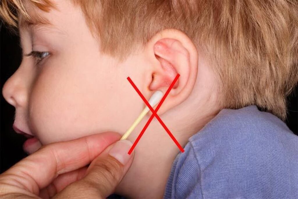 how to get water out of your ear, how to get water out of your ear that won't come out, how to get water out of your ear when nothing else works, how to get water out of your ear after swimming, how to get pool water out of your ear, how to get water out of your inner ear, how to get water out of your ear quickly, how to get trapped water out of your ear, how to get water out of your ear drum, ultimate guide, Symptoms of swimmer's ear