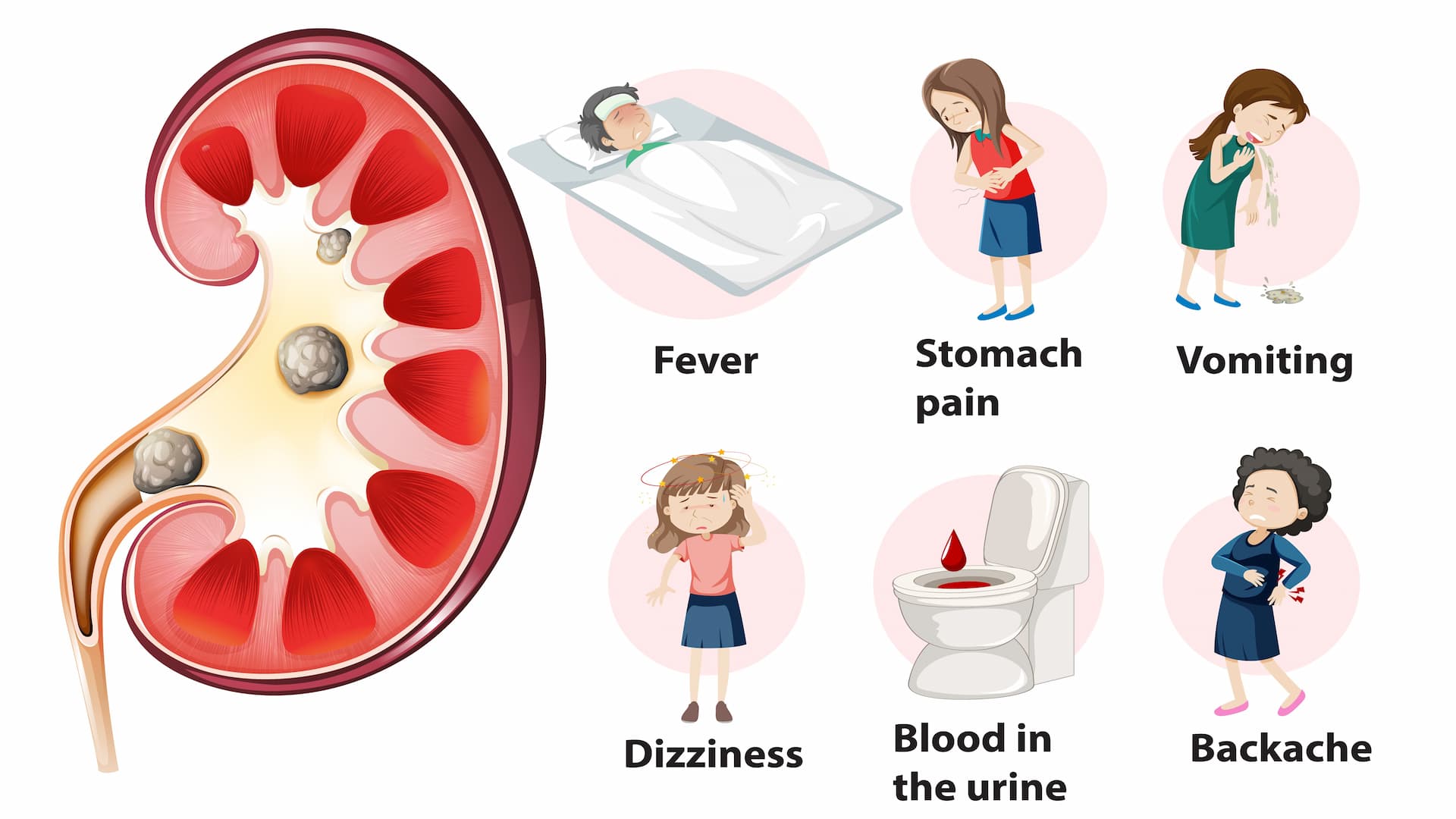 how long does it take for a kidney stone to pass prime wellness, How Long Does it Take to Pass a Kidney Stone, how long does it take to pass a kidney stone with flomax, how long to pass kidney stone, Kidney Stone, pure ohio wellness, restore hyper wellness, sleep and wellness centers, surterra wellness, theory wellness, ultimate guide, us wellness meats, wellness elements, xpress wellness