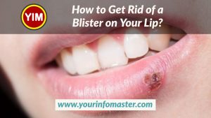 fever blister on lip, Fever Blister Remedies, How long does a fever blister last, How to Get Rid of a Blister on Your Lip, how to get rid of a fever blister in 24 hours, how to treat blisters on lips, Natural home remedies for fever blisters, pure ohio wellness, restore hyper wellness, surterra wellness, theory wellness, ultimate guide, us wellness meats, wellness elements, xpress wellness