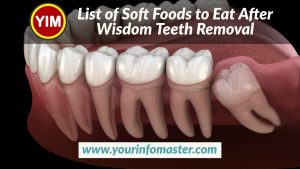 List of Soft Foods to Eat After Wisdom Teeth Removal, pure ohio wellness, restore hyper wellness, Soft Foods to Eat After Wisdom Teeth Removal, Solid Foods to Eat After Wisdom Teeth Removal, surterra wellness, theory wellness, ultimate guide, us wellness meats, wellness elements, when can i eat solid food after wisdom teeth removal, Wisdom Teeth Removal, xpress wellness