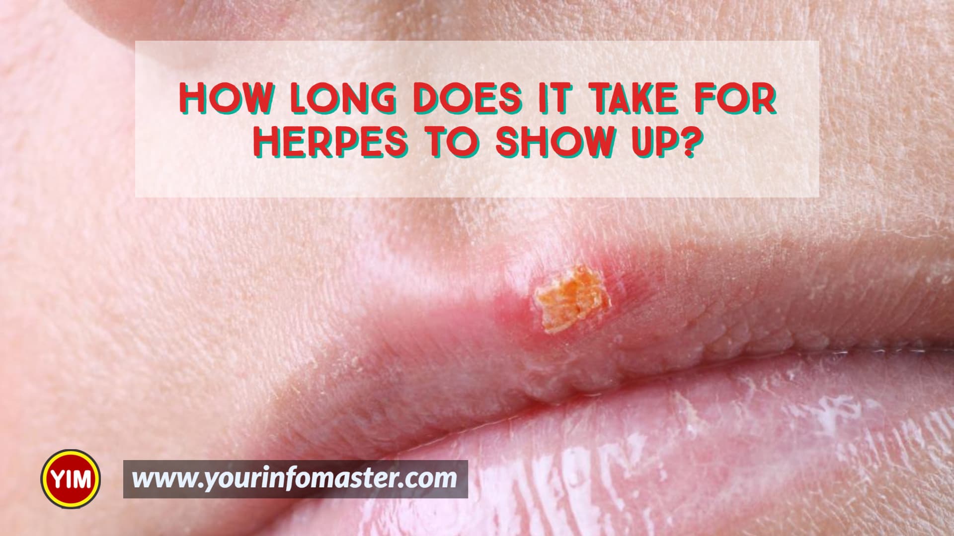 Can you have herpes and not know, Herpes incubation periods, How Long Does it Take for Herpes to Show up, How long does it take for symptoms of herpes to appear, How soon can you be tested, How to prevent the spread of herpes, Type of tests used to diagnose herpes