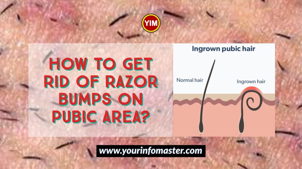 9 ways to treat and prevent razor burn
