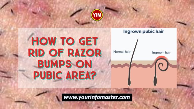 How are ingrown pubic hairs treated, How to Get Rid of Razor Bumps on Pubic Area, ingrown pubic hairs, What causes ingrown pubic hairs