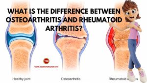 What is the difference between Osteoarthritis and Rheumatoid arthritis