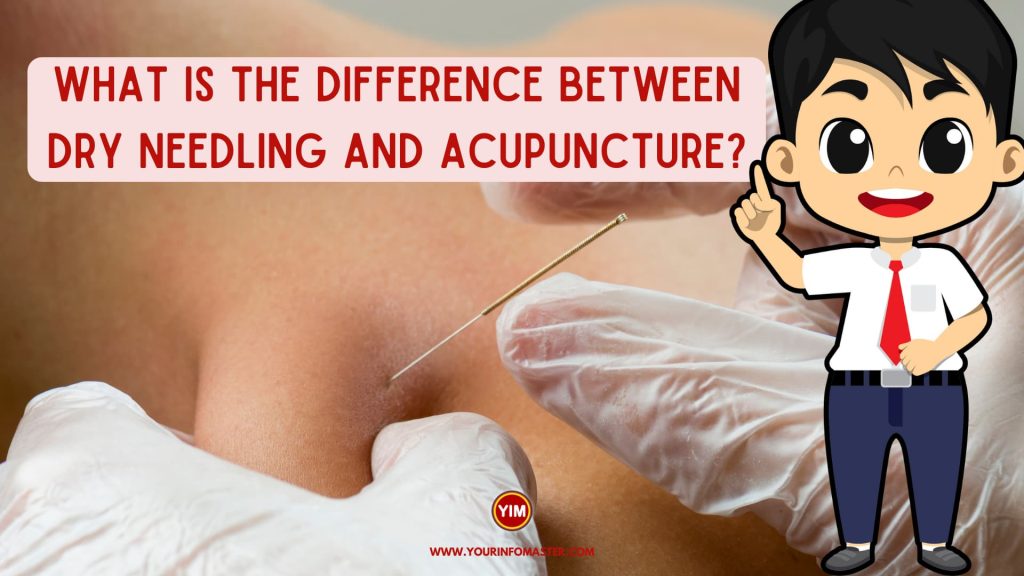 What is the difference between dry needling and acupuncture