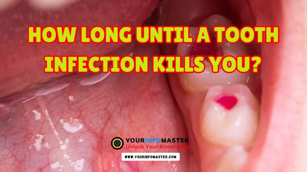 How Long Until a Tooth Infection Kills You